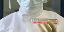 Denti e gengive che si rigenerano: la nuova frontiera dell’odontoiatria con le staminali