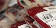 Riceve una trasfusione con sangue incompatibile e muore: un milione e mezzo di risarcimento ai parenti