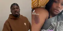 Charlotte Lavish accusa Marcus Thuram di violenza domestica: il video pubblicato su TikTok e l’inchiesta archiviata tre anni fa
