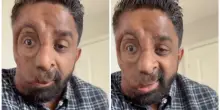 “Ho la neurofibromatosi di tipo 1. Non mi hanno servito in un bar per il mio viso. Mi fissavano come se avessero visto un fantasma”: la storia di Amit Ghose