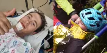 Come sta Alessio Martinelli dopo la tremenda caduta al Giro d’Italia: la foto dall’ospedale