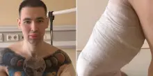 Si inietta l’olio nei bicipiti per renderli più grossi e viene ricoverato d’urgenza in ospedale: l’incidente del “Braccio di Ferro” russo Kirill Tereshin