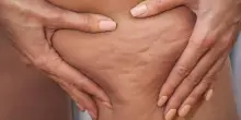 Gambe pesanti con il caldo? I consigli degli esperti, i massaggi e i prodotti anti-cellulite per coccolare il corpo in estate