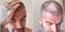“Stai malissimo, ma che hai combinato in testa?”: incidente casalingo per David Beckham. La moglie Victoria infierisce