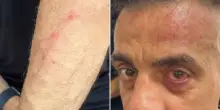 “Mi hanno colpito con un pezzo di legno. Mi sono difeso con lo spray al peperoncino”: lo YouTuber Simone Cicalone aggredito alla stazione di Napoli