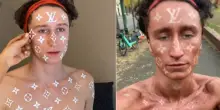 Si abbronza lasciando i loghi di Louis Vuitton sulla pelle: il tutorial per una tintarella griffata diventa virale – VIDEO