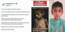 Dimesso Osama, il bimbo di Gaza. I medici: “Guerra concausa della malnutrizione”. Per Israele erano bufale
