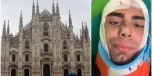 Rapina a Milano, 25enne aggredito con un martello: “Mi hanno spaccato la testa per un orologio di m…”