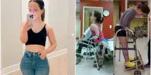 “Non mi sono mai sentita nana, ma odiavo essere trattata come una cane da esposizione. Ora sono una ‘bassa comoda’”: la storia di Chandler Crews, che ha speso 2 milioni per farsi allungare gambe e braccia
