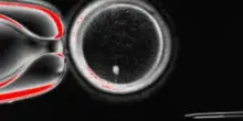 “Ovuli fecondabili dalle cellule della pelle”, lo studio su Nature. Gli scienziati: “Concetto sperimentale contro l’infertilità”
