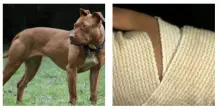 “Un pitbull senza guinzaglio ha attaccato mia figlia, sono riuscita ad afferrarla ma lui allora mi ha morso la mano”: il drammatico assalto e la decisione di sopprimere il cane