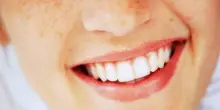 Giornata Mondiale del Sorriso, migliora la qualità della vita
