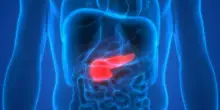 Tumore al pancreas, bere alcol aumenta il rischio cancro: ecco perché e differenze tra uomo e donna