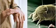 Allergie estive: come riconoscerle (e quando preoccuparsi). Sintomi, cause e rimedi