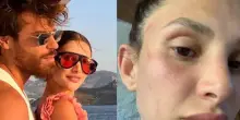 Sara Bluma denuncia le violenze dell'ex, il fidanzato Can Yaman: «Ti amo e ti sosterrò. Non lo ha tradito con me»