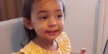 Celeste muore a due anni per una malattia rara, stroncata in sei mesi. La mamma: «All'inizio erano solo bronchioliti»
