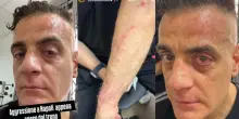 Simone Cicalone picchiato a Napoli, lo youtuber e la videomaker aggrediti in stazione: «Tu qui non fai riprese»