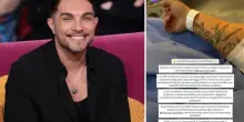 Marco Carta ricoverato in ospedale dopo un malore: annullato il concerto. Cosa è successo e come sta ora il cantante