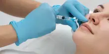 Botox e acido ialuronico su Instagram a prezzi stracciati: chiuso centro abusivo dopo la denuncia di una paziente con il naso in necrosi