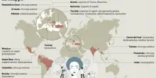 Interventi per allungare gli arti in Turchia. «Mi è costato 29mila euro, ora sono più alto e supero mia moglie»