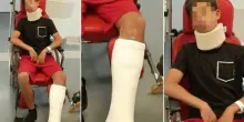 Parla il padre che ha picchiato il calciatore 13enne: «Mi dispiace, ma non è andata come dicono». L'altra versione