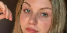 Eleonora Chieregato muore a 17 anni per una malattia autoimmune: i primi sintomi ad aprile, il malore in treno e il decesso