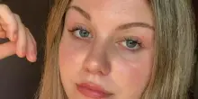 Nausea, stanchezza, poi il malore in treno: Eleonora Chieregato muore a 17 anni per una malattia autoimmune. I primi sintomi ad aprile