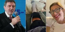?Marco Marsilio, incidente in Harley per il presidente dell'Abruzzo: lui resta illeso, la moglie si rompe una gamba. «Amore, che ho combinato»