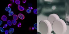 Tumore del colon-retto, l'Aspirina dimezza il rischio di recidiva: lo studio del team svedese