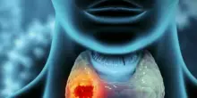 L'Ai nella diagnosi della tiroide: aiuterà i medici a prendere decisioni migliori