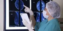 Tumore al seno, lo studio per ridurre i trattattamenti: così saranno possibili più cure personalizzate