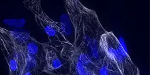 Scoperta chiave per la salute del cuore e la diagnosi delle cardiomiopatie