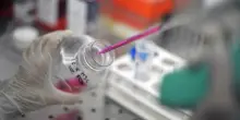 Alzheimer, le placche che causano la malattia possono essere regolate: la scoperta che apre a nuove cure