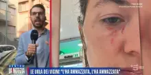 Pamela Genini, Gianluca Soncin l'aveva picchiata e minacciata con una pistola. L'amica: «Ha dato fiducia alla persona sbagliata», le foto delle violenze