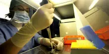 Tumore polmoni e melanoma, vaccini Covid Rma raddoppiano efficacia terapia immunitaria
