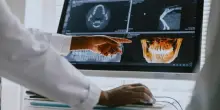 Staminali e gel biologici risanano ossa, impianti dentali più veloci: le nuove cure odontoiatriche