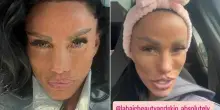 Katie Price, le punture di botox finiscono male: «Al momento ho delle gobbe sul viso»