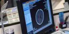 Salute, Padovani (Sin): "Longevità aumenta rischio Alzheimer, agire su prevenzione"