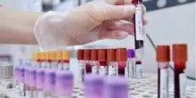 Cancro al seno, oncologi: "Bene test genomici nei nuovi Lea, fare presto"