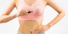 Cancro seno, esperti 'in Campania biopsia liquida utile per 720 donne l’anno'