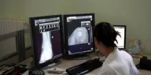 Un italiano su 4 è over 65, Sirm: "Prevenzione personalizzata con radiologia geriatrica"