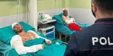 Esplosione Roma, l'agente ferito: "Consapevole del pericolo, lo rifarei"