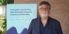 Nefrologi: "Successo in 85% casi per cura contro prurito in malattia renale cronica"