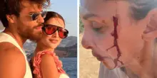 Can Yaman, la fidanzata Sara Bluma denuncia le violenze dell'ex. L'attore: "Ti amo"