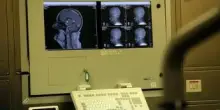 Medicina: Congresso Sin, neurologia tra innovazione, responsabilità e nuova organizzazione