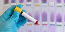 Iss, in arrivo un piano nazionale contro epatiti e hiv