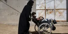 Onu, almeno 21.000 bimbi a Gaza disabili a causa guerra