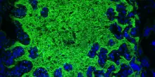 Le diete yo-yo alterano per molto tempo i batteri dell'intestino