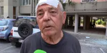 Esplosione Roma, il testimone: "Ferito da un vetro in testa mentre ero sul balcone al quarto piano"