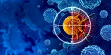 Tumori, la rete oncologica dell’Emilia-Romagna al top per le migliori cure